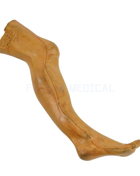 False Leg